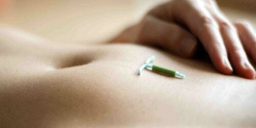¿Cómo funciona el dispositivo intrauterino?