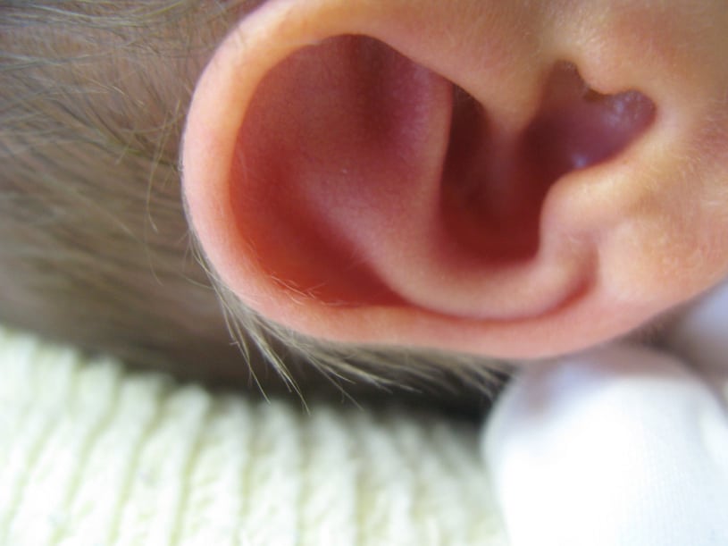 La audición en recién nacidos