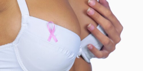Cáncer de mama: ¿Qué debo preguntar a los doctores?