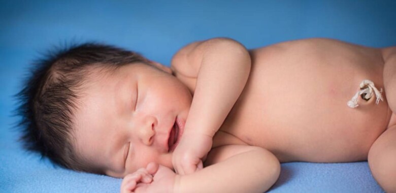 cordón umbilical de bebes