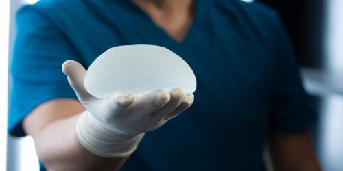¿Implantes?