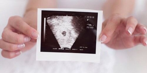 Células madre y su beneficio en el futuro de tu hijo