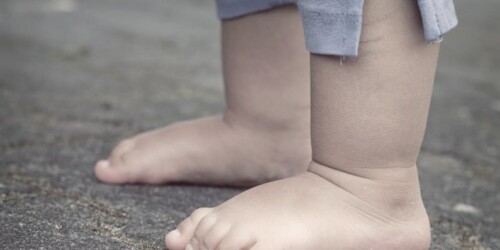 ¿Cómo saber si mi hijo tiene pie plano?