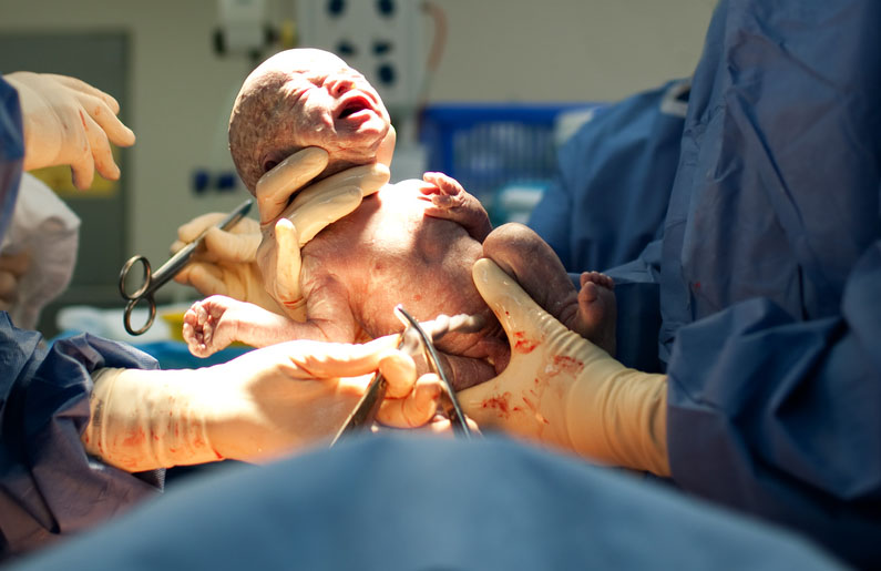 Lesiones del bebé durante el parto