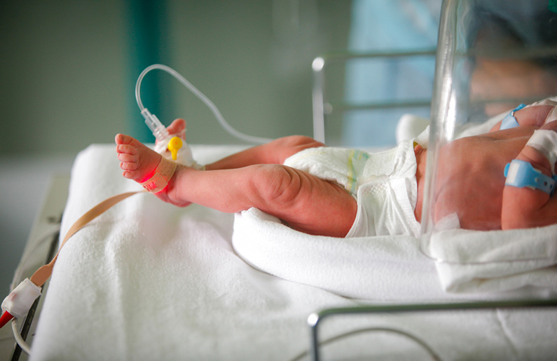 Terapia intensiva: cuando tu recién nacido sufre una complicación