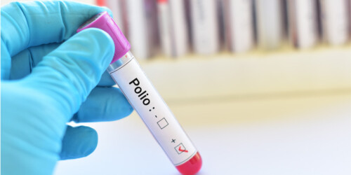 La polio, todo lo que necesitas saber
