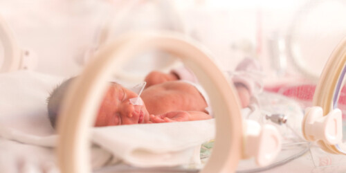 ¿Por qué hay más bebés prematuros en México?
