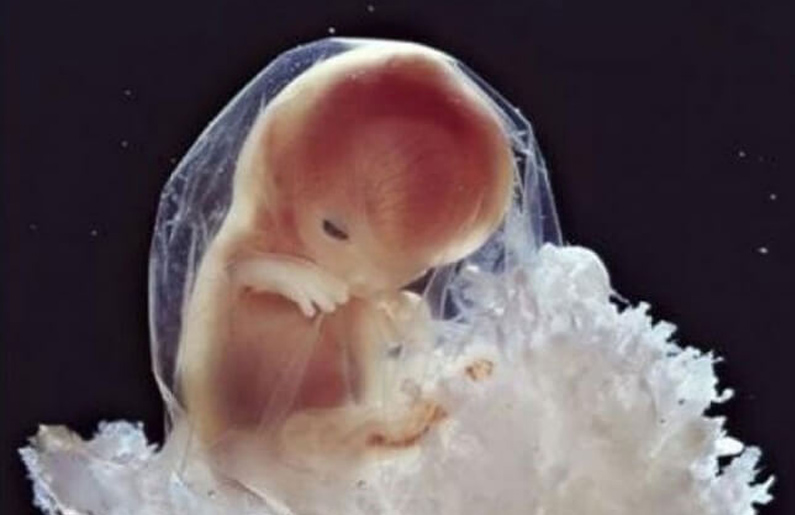 Galería: Así evoluciona el bebé en el vientre