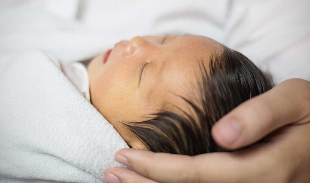 La ictericia y su relación con el oído del recién nacido