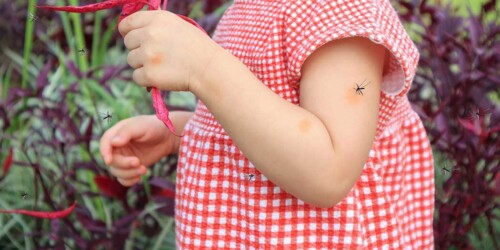 ¿Por qué los mosquitos pican a unos y a otros no?
