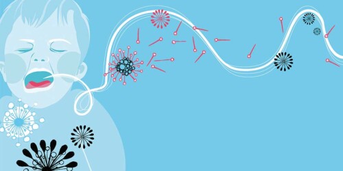 ¿Qué es la laringomalacia de los bebés?