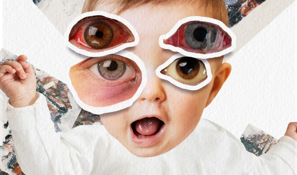 ¿Qué dicen los ojos sobre la salud de tus hijos?
