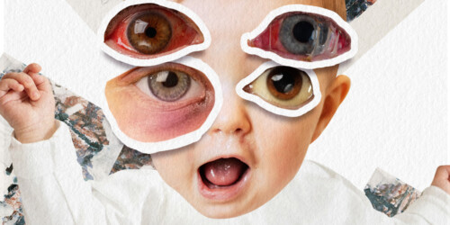 ¿Qué dicen los ojos sobre la salud de tus hijos?