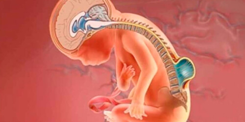 ¿Cuáles son las enfermedades raras más comunes en México?