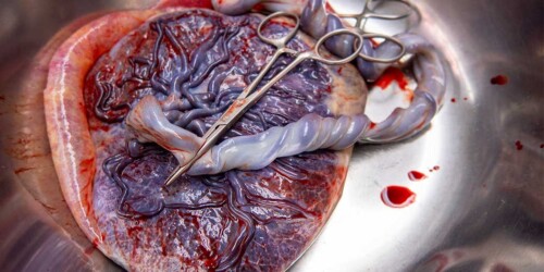 Beneficios de encapsular y consumir tu placenta