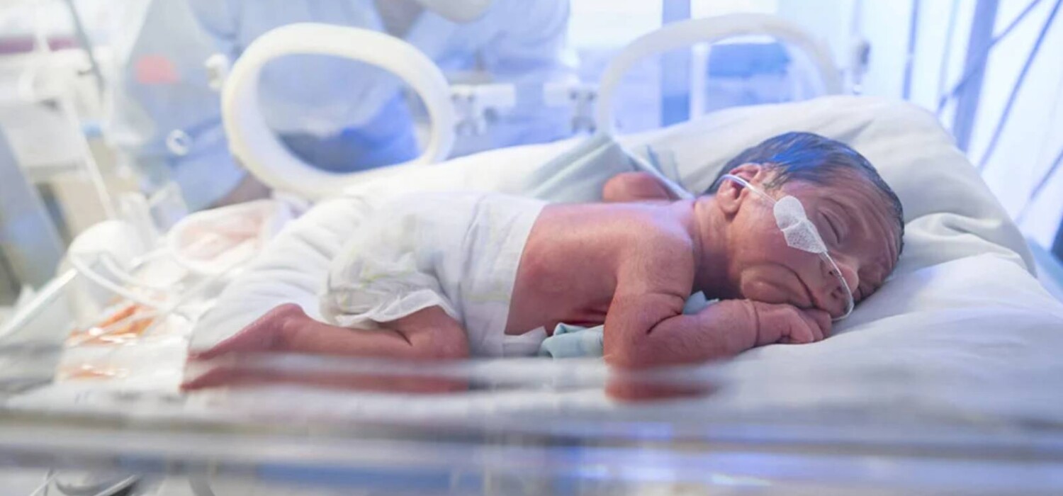 BEBE PREMATURO