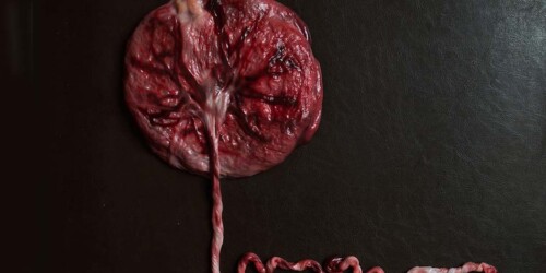4 recomendaciones para tener una placenta fuerte