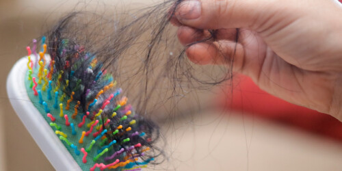 ¿Por qué se le cae el pelo a mi hijo?
