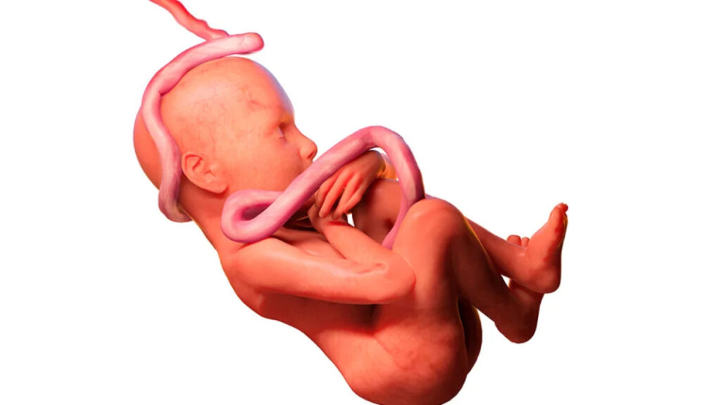 5 problemas que pueden suceder con el cordón umbilical