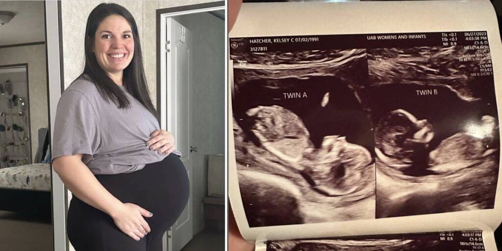 El caso de Kelsey, la mujer que tiene doble útero y está embarazada