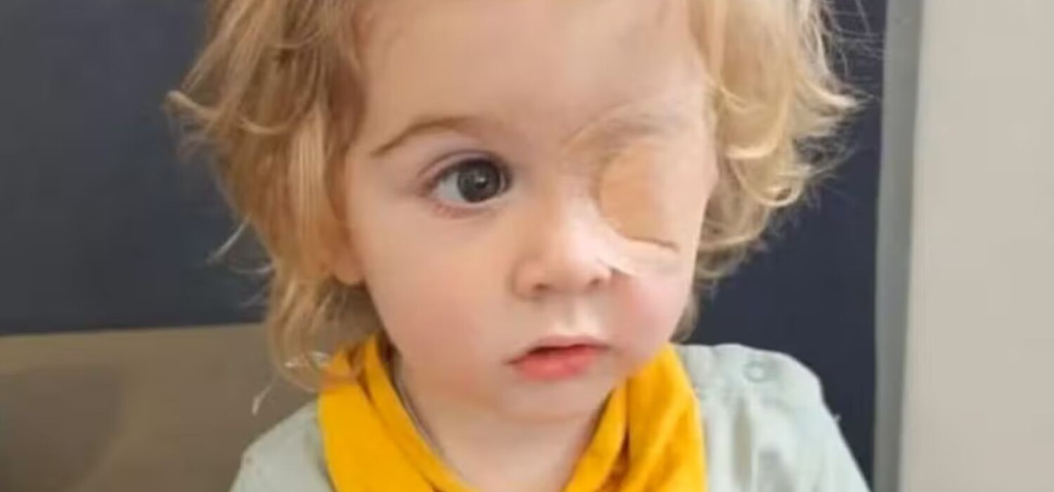 niño pierde ojo por herpes
