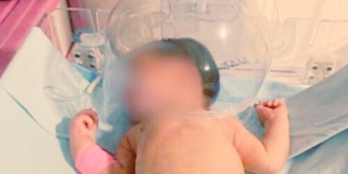 Bebé atendido con botella de plástico en hospital de Tabasco