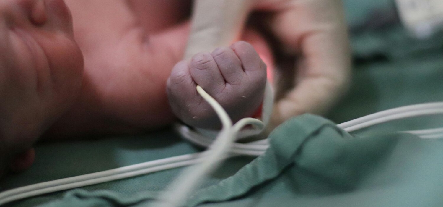 muerte cerebral bebes