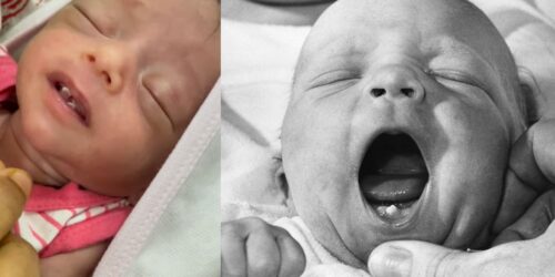 ¿Los bebés pueden nacer con dientes?