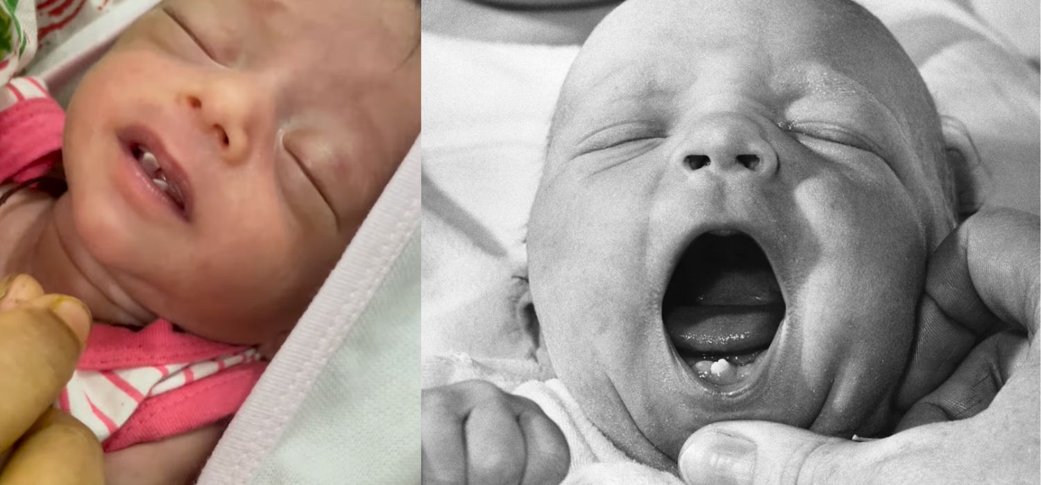 bebés nacen con dientes