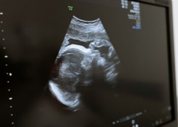 Cosas que tu bebé aprende en el útero durante el embarazo