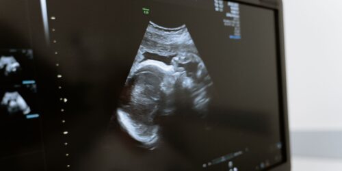 Cosas que tu bebé aprende en el útero durante el embarazo