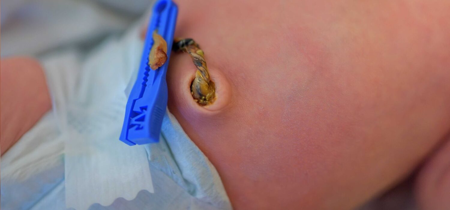 cuidados cordon umbilical