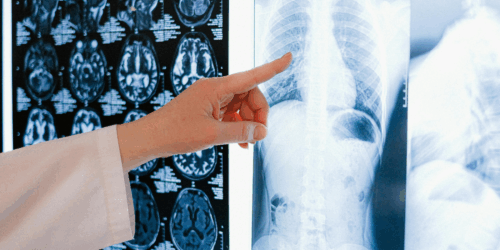 ¿Me puedo hacer rayos X estando embarazada?