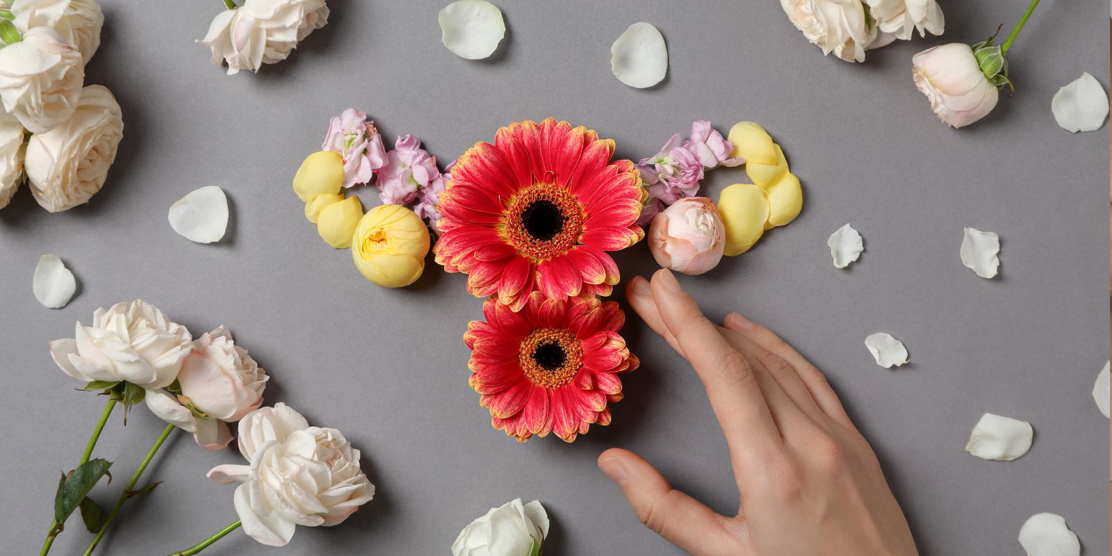 Tres cirugías ginecológicas robóticas