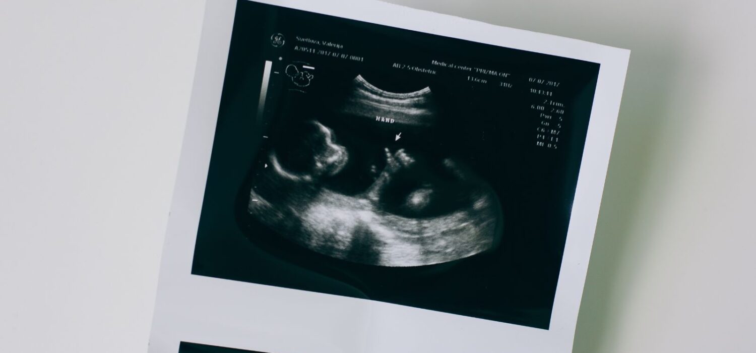 bebes reconocen voz desde el vientre