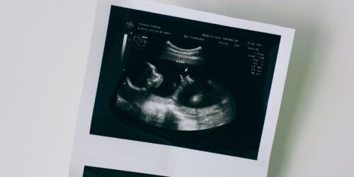 Tu bebé reconoce el lenguaje desde el vientre (antes de lo que imaginabas)