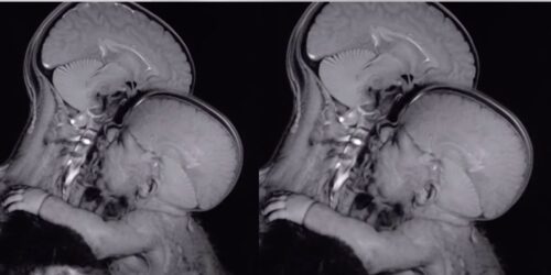 Abrazar y acompañar: palabras clave en el proceso de crianza