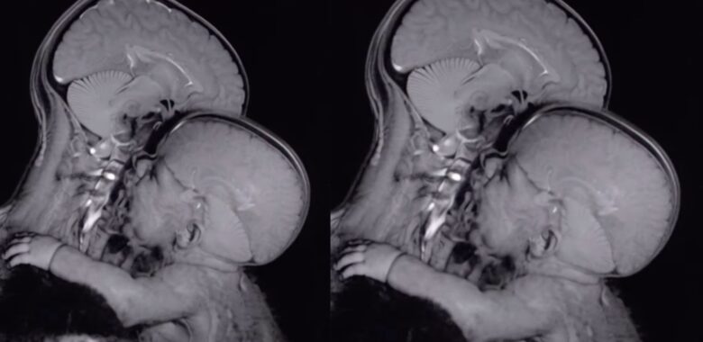 Abrazar y acompañar: palabras clave en el proceso de crianza