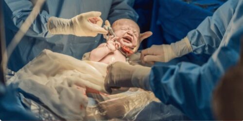 Las cesáreas superan por primera vez a los partos vaginales
