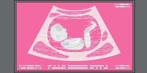 ¿Por qué los bebés patean cuando están en la panza?