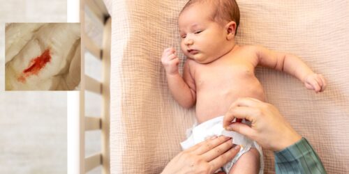 Falsa menstruación en bebés: por qué tu recién nacida puede sangrar