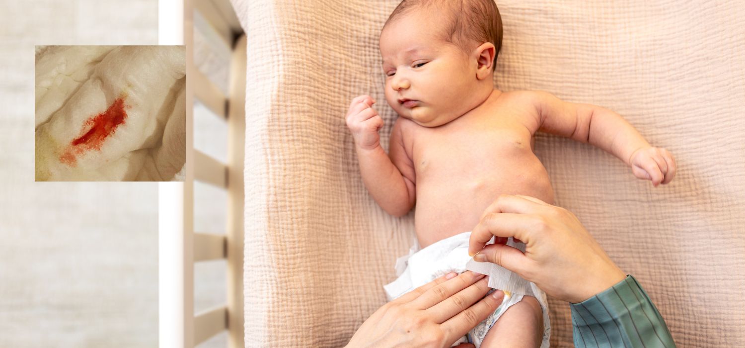 Falsa menstruación en bebés