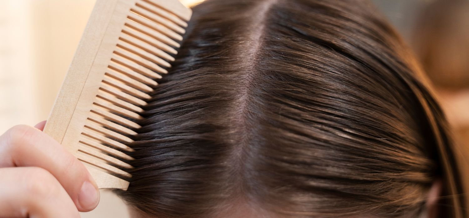 pérdida de pelo en el posparto