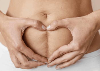 6 recomendaciones para recuperarte después de una cesárea