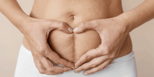 6 recomendaciones para recuperarte después de una cesárea