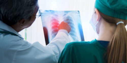 ¿Abuelito estás bien? Cuando la tuberculosis se confunde con vejez