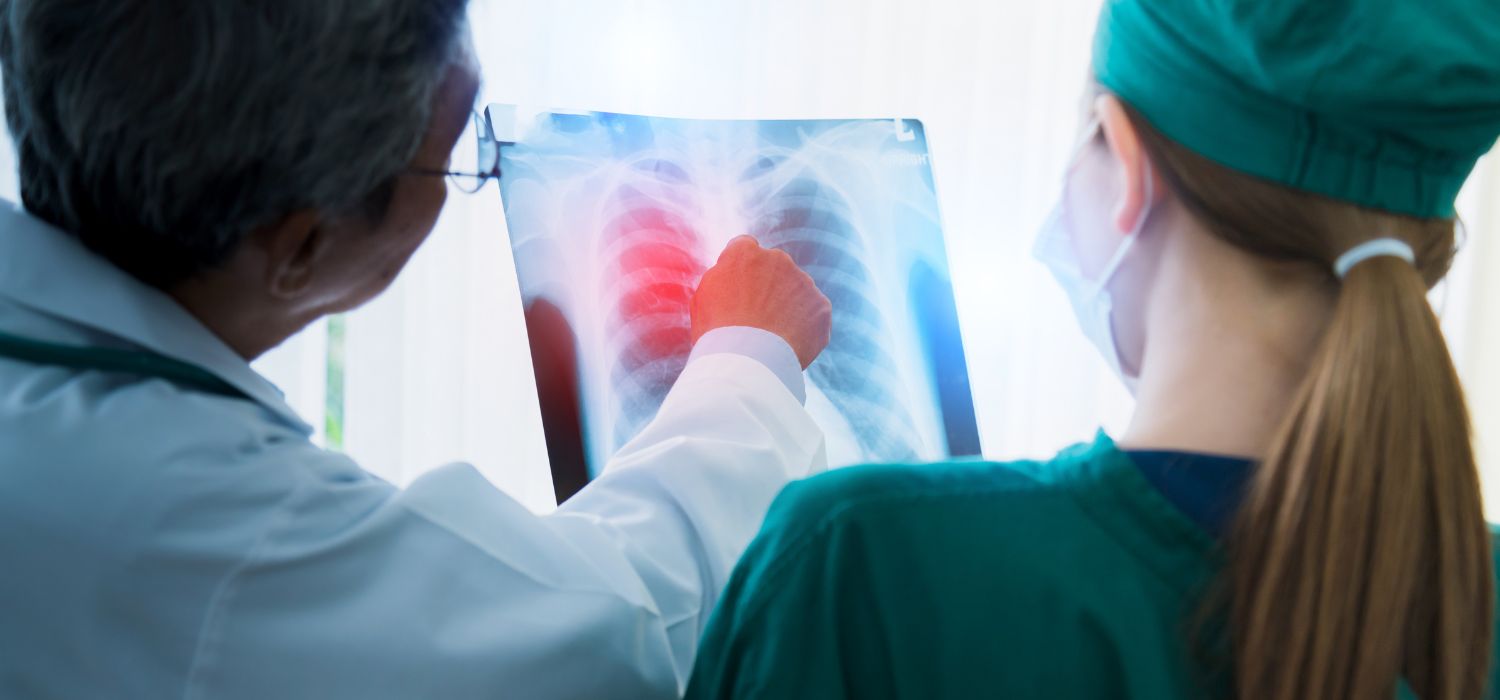 ¿Abuelito estás bien? Cuando la tuberculosis se confunde con vejez