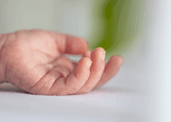 Una bebé de 7 meses murió por sarampión en CDMX