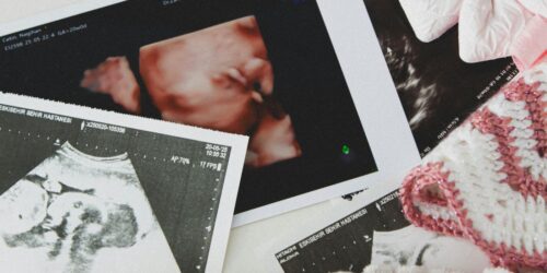 Los 4 ultrasonidos más importantes en el embarazo: qué debes revisar
