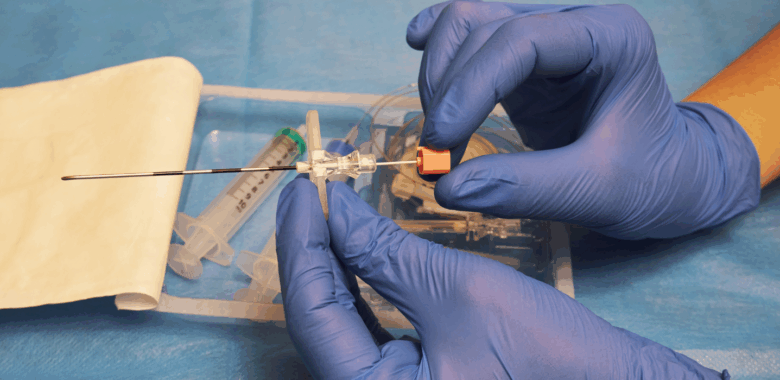 Epidural ambulatoria o «walking epidural»: Parir sin dolor y con movilidad es posible